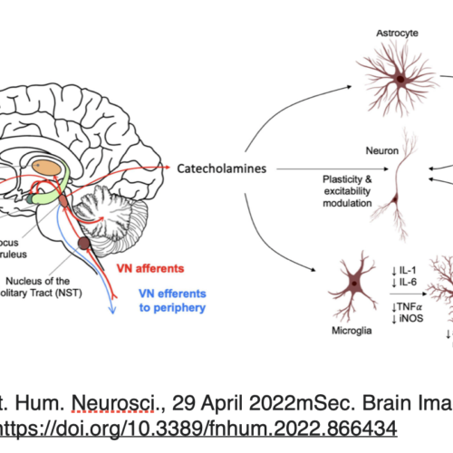 Aktywacja neuronów w nieinwazyjnej stymulacji nerwu błędnego tVNS.